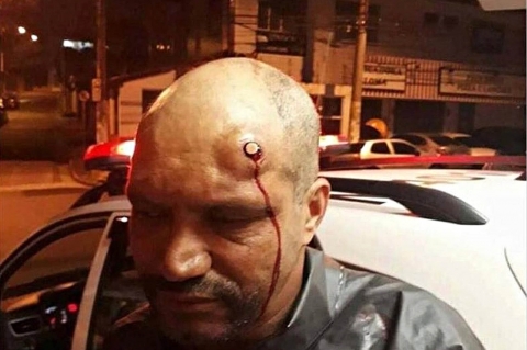 Man survives an Head Shot!